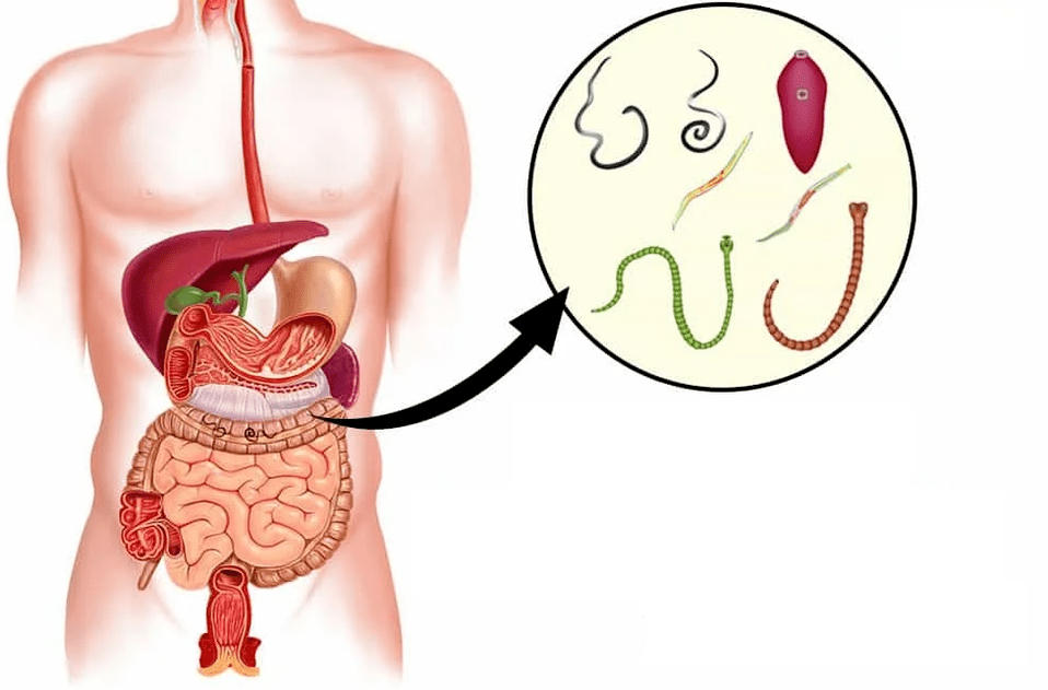 Helminths and worms in the gastrointestinal tract. 