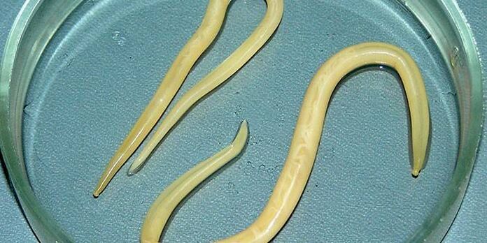 Human roundworms in a petri dish parasitize the walls of the small intestine