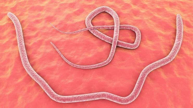 intestinal worms in the human body