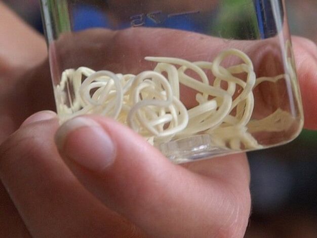 Worms in a jar