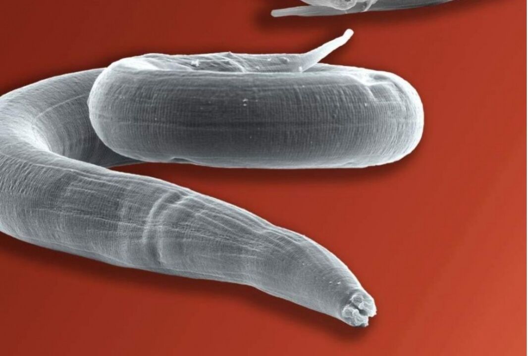 pinworms of the human body