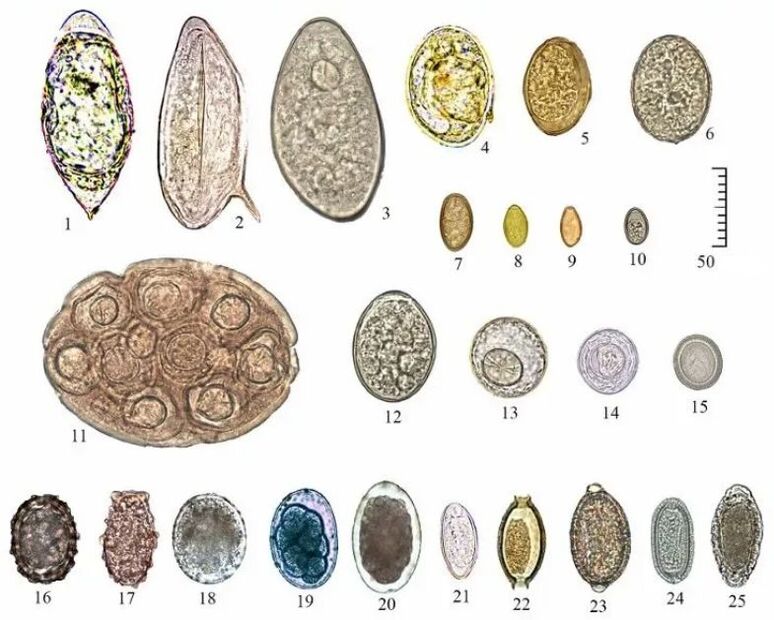 Shape and size of eggs of different helminths.