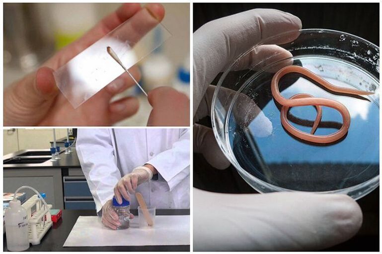 tests to detect the presence of worms in the body
